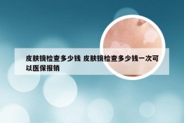 皮肤镜检查多少钱 皮肤镜检查多少钱一次可以医保报销