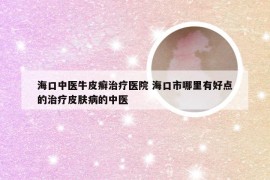 海口中医牛皮癣治疗医院 海口市哪里有好点的治疗皮肤病的中医