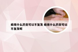 癣用什么药膏可以不复发 癣用什么药膏可以不复发呢