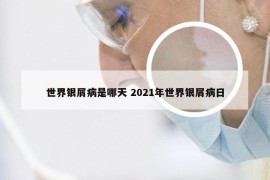 世界银屑病是哪天 2021年世界银屑病日