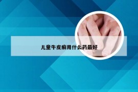 儿童牛皮癣用什么药最好