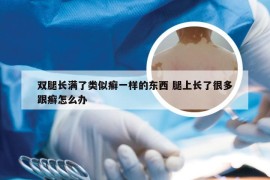 双腿长满了类似癣一样的东西 腿上长了很多跟癣怎么办