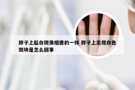 脖子上起白斑像烟唐的一样 脖子上出现白色斑块是怎么回事