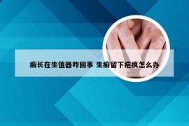 癣长在生值器咋回事 生癣留下疤痕怎么办