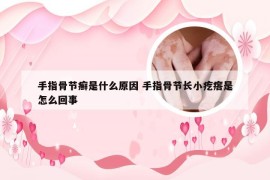 手指骨节癣是什么原因 手指骨节长小疙瘩是怎么回事