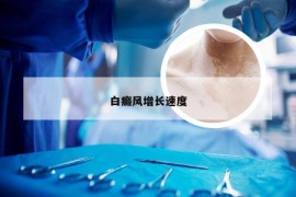 白癜风增长速度