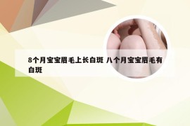 8个月宝宝眉毛上长白斑 八个月宝宝眉毛有白斑