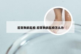 后背胸前起癣 后背胸前起癣怎么办