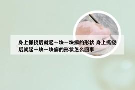 身上抓挠后就起一块一块癣的形状 身上抓挠后就起一块一块癣的形状怎么回事