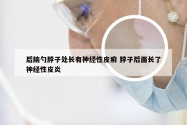 后脑勺脖子处长有神经性皮癣 脖子后面长了神经性皮炎