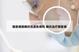 银屑病用碘伏洗澡有用吗 碘伏治疗银屑病