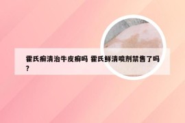 霍氏癣清治牛皮癣吗 霍氏鲜清喷剂禁售了吗?