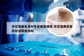 华佗宝典乳膏对牛皮癣管用吗 华佗宝典软膏药对湿疹有效吗