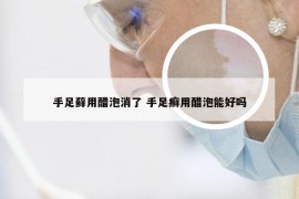 手足藓用醋泡消了 手足癣用醋泡能好吗