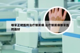 哪家正规医院治疗银屑病 冶疗银屑病那家医院最好