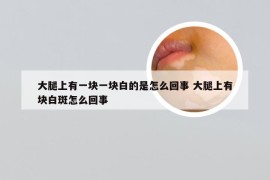 大腿上有一块一块白的是怎么回事 大腿上有块白斑怎么回事