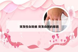 突发性白斑病 突发白斑的原因