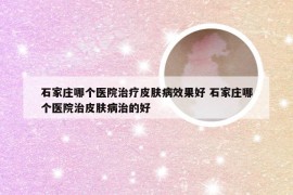 石家庄哪个医院治疗皮肤病效果好 石家庄哪个医院治皮肤病治的好