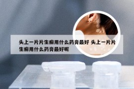 头上一片片生癣用什么药膏最好 头上一片片生癣用什么药膏最好呢