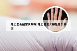 身上怎么经常长癣呢 身上老爱长癣是什么原因