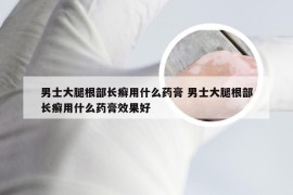 男士大腿根部长癣用什么药膏 男士大腿根部长癣用什么药膏效果好