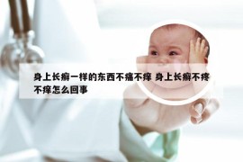 身上长癣一样的东西不痛不痒 身上长癣不疼不痒怎么回事