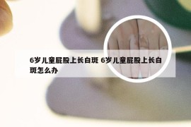 6岁儿童屁股上长白斑 6岁儿童屁股上长白斑怎么办