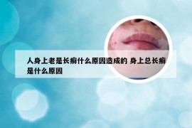 人身上老是长癣什么原因造成的 身上总长癣是什么原因