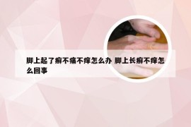 脚上起了癣不痛不痒怎么办 脚上长癣不痒怎么回事