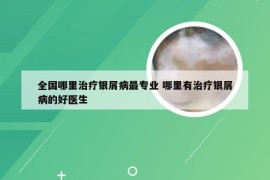 全国哪里治疗银屑病最专业 哪里有治疗银屑病的好医生