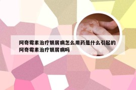 阿奇霉素治疗银屑病怎么用药是什么引起的 阿奇霉素治疗银屑病吗