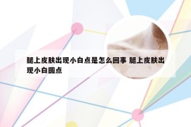 腿上皮肤出现小白点是怎么回事 腿上皮肤出现小白圆点