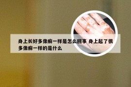 身上长好多像癣一样是怎么回事 身上起了很多像癣一样的是什么