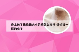 身上长了像榆钱大小的癣怎么治疗 像榆钱一样的虫子