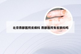 北京燕都医院皮癣科 燕都医院有皮肤科吗