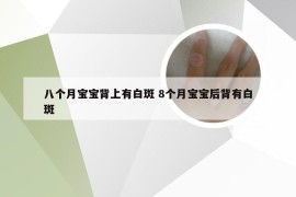 八个月宝宝背上有白斑 8个月宝宝后背有白斑