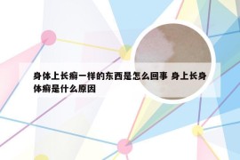 身体上长癣一样的东西是怎么回事 身上长身体癣是什么原因