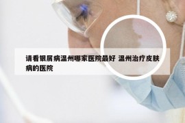 请看银屑病温州哪家医院最好 温州治疗皮肤病的医院