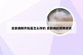 皮肤病刚开始是怎么样的 皮肤病的初期症状