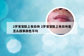 2岁宝宝脸上有白块 2岁宝宝脸上有白块是怎么回事肤色不均