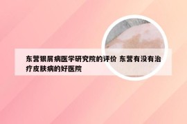 东营银屑病医学研究院的评价 东营有没有治疗皮肤病的好医院