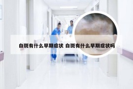 白斑有什么早期症状 白斑有什么早期症状吗