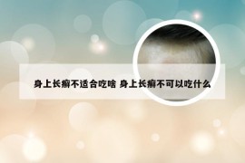 身上长癣不适合吃啥 身上长癣不可以吃什么