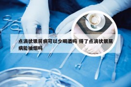 点滴状银屑病可以少喝酒吗 得了点滴状银屑病能抽烟吗