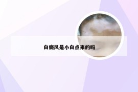 白癜风是小白点来的吗