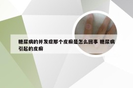 糖尿病的并发症那个皮癣是怎么回事 糖尿病引起的皮癣