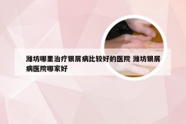 潍坊哪里治疗银屑病比较好的医院 潍坊银屑病医院哪家好