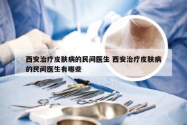 西安治疗皮肤病的民间医生 西安治疗皮肤病的民间医生有哪些