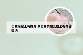 出生后脸上有白斑 刚出生的婴儿脸上有白色斑块