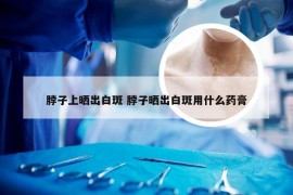 脖子上晒出白斑 脖子晒出白斑用什么药膏